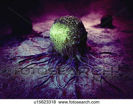 Cancer cell View Large Photo Image Stock Photo - Cancer cell. Fotosearch