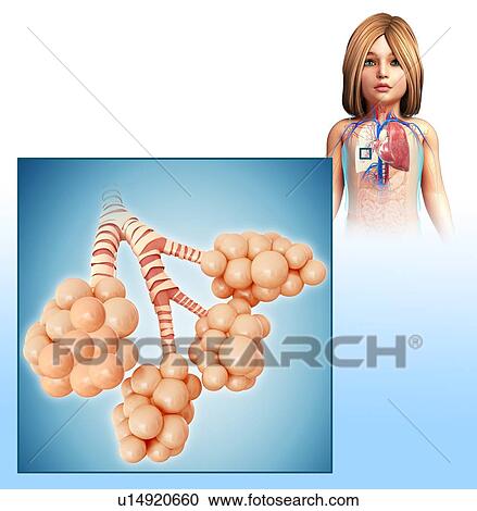 Stock Image - Child's alveoli, illustration. Fotosearch