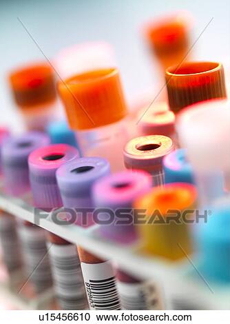 Stock Image - Clinical testing. Fotosearch