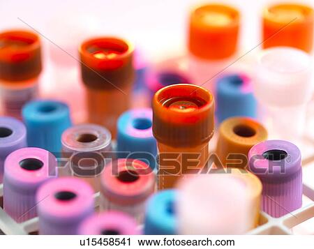 Stock Image - Clinical testing. Fotosearch