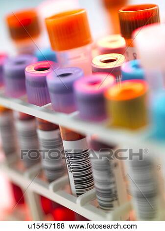 Stock Photo - Clinical testing. Fotosearch