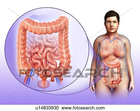 Stock Image - Diverticulosis, illustration. Fotosearch