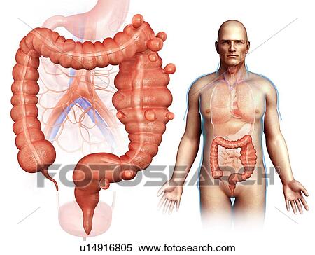 Stock Photography - Diverticulosis, illustration. Fotosearch