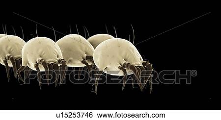 Dust mites View Large Photo Image Stock Photograph - Dust mites. Fotosearch