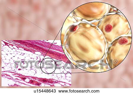 Fat cells, illustration View Large Photo Image Stock Image - Fat cells, illustration. Fotosearch