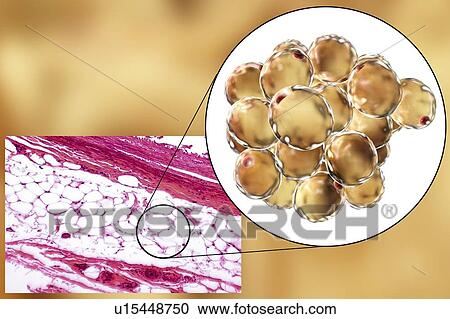 Fat cells, illustration View Large Photo Image Stock Image - Fat cells, illustration. Fotosearch