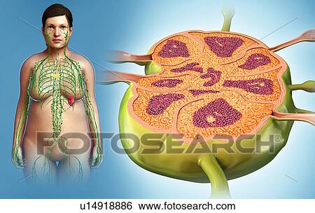 Stock Photograph - Female lymph node, illustration. Fotosearch