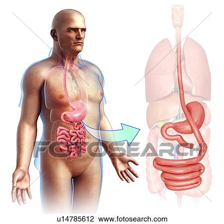 Stock Image - Gastric bypass, illustration. Fotosearch