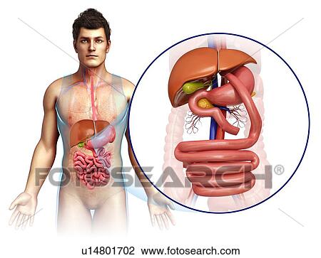 Stock Image - Gastric bypass, illustration. Fotosearch