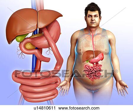 Gastric bypass, illustration View Large Photo Image Stock Image - Gastric bypass, illustration. Fotosearch
