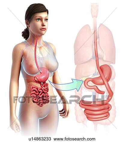 Gastric bypass, illustration View Large Photo Image Stock Image - Gastric bypass, illustration. Fotosearch