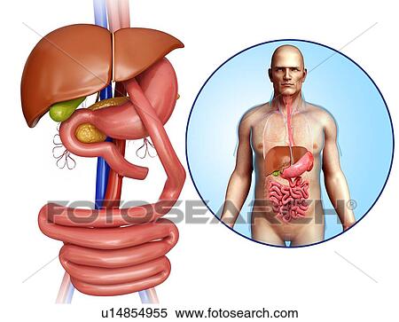Stock Photography - Gastric bypass, illustration. Fotosearch