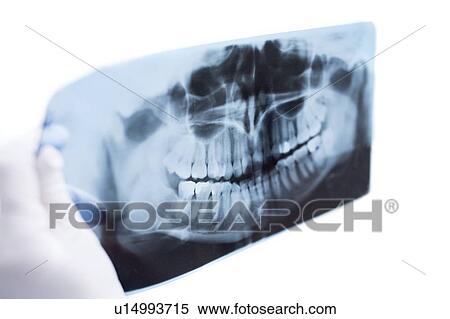 Holding teeth model and x-ray View Large Photo Image Stock Photography - Holding teeth model and x-ray. Fotosearch