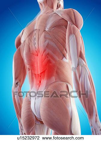 Human back pain View Large Photo Image Stock Image - Human back pain. Fotosearch