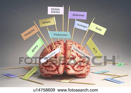 Stock Photo - Human brain with medical conditions. Fotosearch