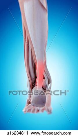 Human foot pain View Large Photo Image Stock Image - Human foot pain. Fotosearch