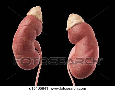 Stock Image - Human kidneys. Fotosearch
