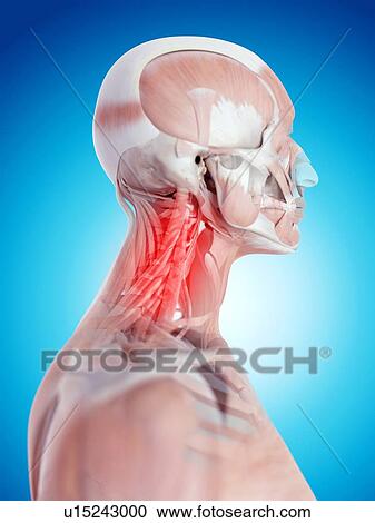 Stock Image - Human neck pain. Fotosearch