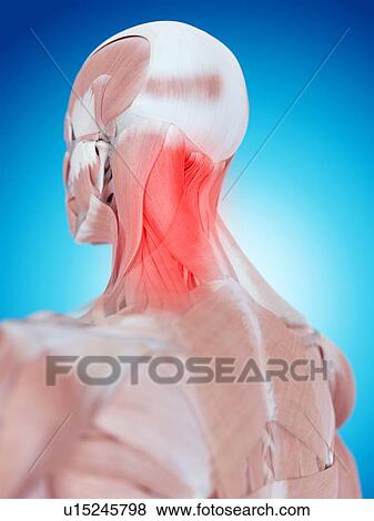 Human neck pain View Large Photo Image Stock Photo - Human neck pain. Fotosearch