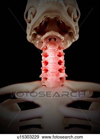 Human neck pain View Large Photo Image Stock Photo - Human neck pain. Fotosearch