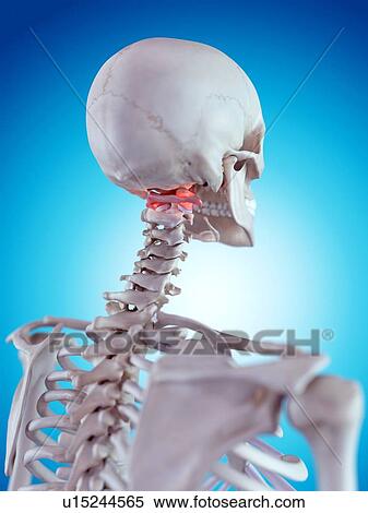 Stock Photography - Human neck pain. Fotosearch