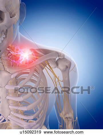 Human nerve pain View Large Photo Image Stock Photo - Human nerve pain. Fotosearch