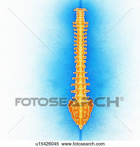 Human spinal vertebrae, illustration View Large Photo Image Stock Photography - Human spinal vertebrae, illustration. Fotosearch