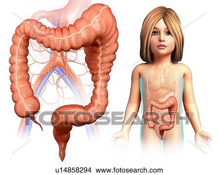 Megacolon, illustration View Large Photo Image Picture - Megacolon, illustration. Fotosearch