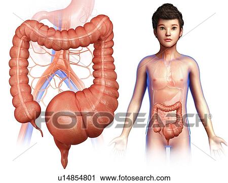 Megacolon, illustration View Large Photo Image Stock Image - Megacolon, illustration. Fotosearch