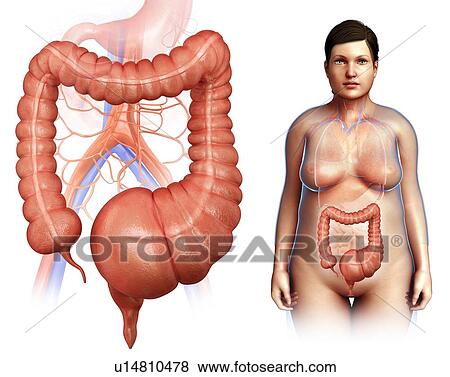 Stock Photo - Megacolon, illustration. Fotosearch