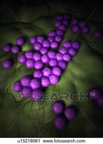 Stock Image - Mrsa bacteria. Fotosearch
