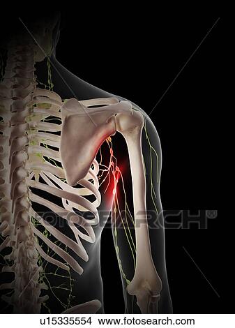 Painful human lymph nodes View Large Photo Image Picture - Painful human lymph nodes. Fotosearch