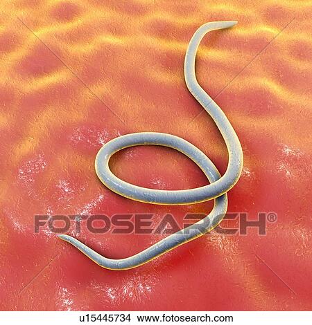 Picture - Threadworm, illustration. Fotosearch