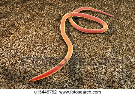 Stock Image - Threadworm, illustration. Fotosearch