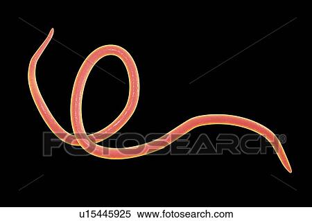 Stock Photography - Threadworm, illustration. Fotosearch