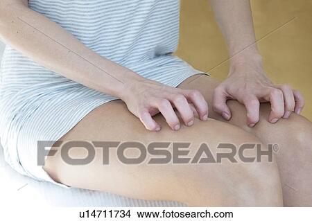 Woman scratching her legs View Large Photo Image Picture - Woman scratching her legs. Fotosearch