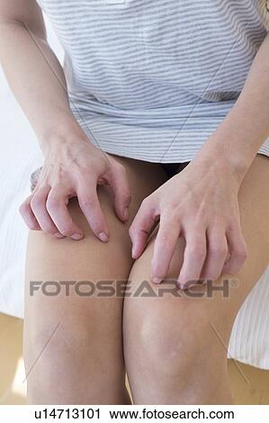 Stock Image - Woman scratching her legs. Fotosearch