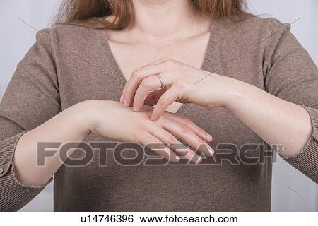 Stock Photograph - Young woman scratching her hand. Fotosearch