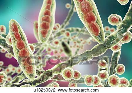 Athlete's foot fungus, illustration View Large Photo Image Stock Image - Athlete's foot fungus, illustration. Fotosearch