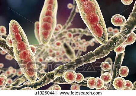 Athlete's foot fungus, illustration View Large Photo Image Stock Image - Athlete's foot fungus, illustration. Fotosearch