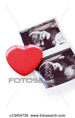 Baby scan photos and red heart View Large Photo Image Stock Photography - Baby scan photos and red heart. Fotosearch