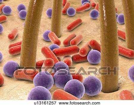 Stock Photo - Bacteria on skin with hairs, illustration. Fotosearch