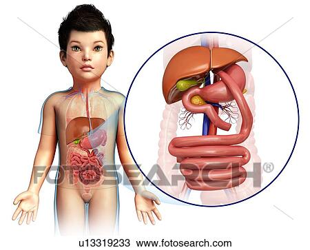 Stock Image - Child's gastric bypass, illustration. Fotosearch