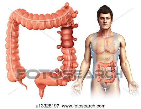 Stock Photo - Diverticulosis, illustration. Fotosearch
