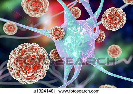 Enteroviruses and neuron, illustration View Large Photo Image Stock Image - Enteroviruses and neuron, illustration. Fotosearch