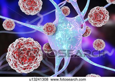 Enteroviruses and neuron, illustration View Large Photo Image Stock Photo - Enteroviruses and neuron, illustration. Fotosearch
