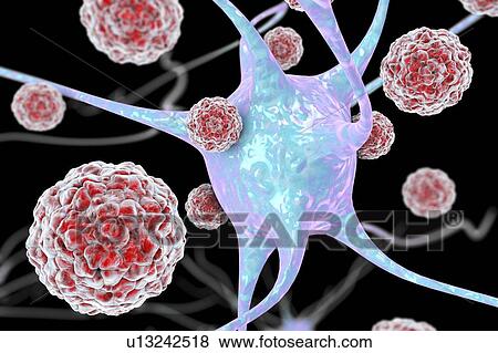 Stock Photo - Enteroviruses and neuron, illustration. Fotosearch