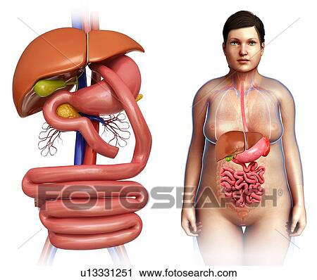 Stock Image - Gastric bypass, illustration. Fotosearch