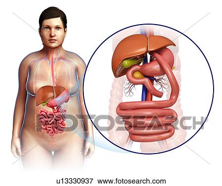 Gastric bypass, illustration View Large Photo Image Stock Photo - Gastric bypass, illustration. Fotosearch