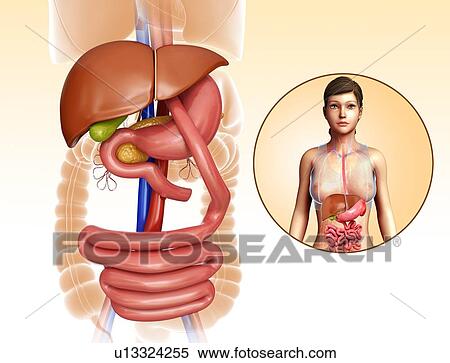 Stock Photography - Gastric bypass, illustration. Fotosearch